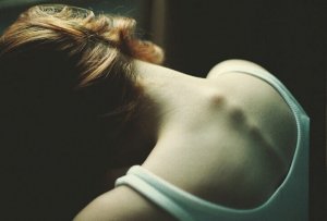 Anorexie : quand être trop mince, ce n'est que la partie visible de l'iceberg