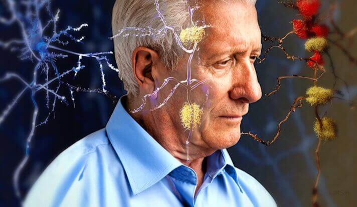 homme et synapses