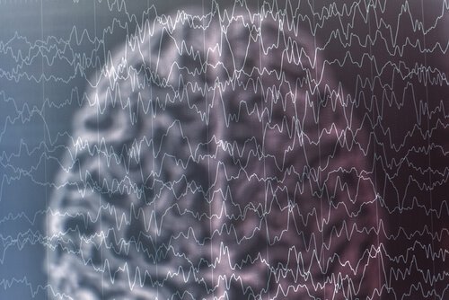 Qu'est-ce que le syndrome de Lennox-Gastaut ?