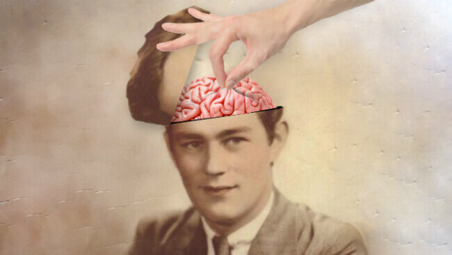 homme qui a la tête ouverte