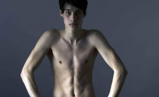 jeune homme souffrant de troubles de l'alimentation