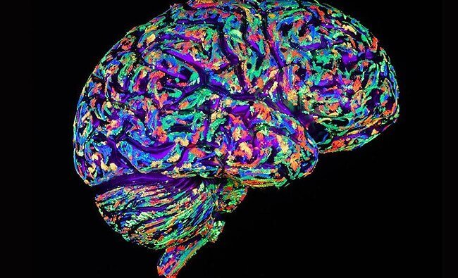 cerveau