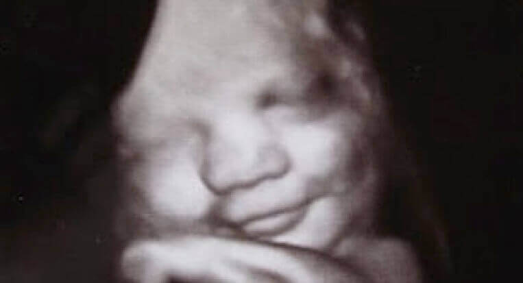 bebe qui sourit dans l'uterus