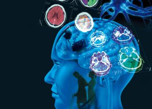 La sclérose en plaques : causes, symptômes et traitement