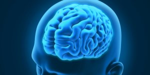 3 troubles neurologiques curieux et intéressants