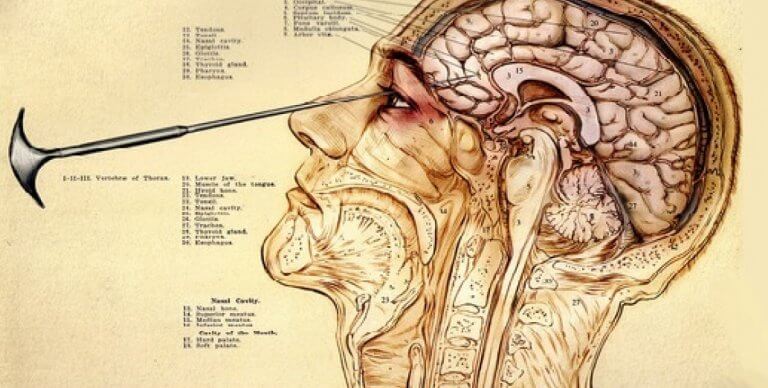 histoire de la lobotomie transorbitale