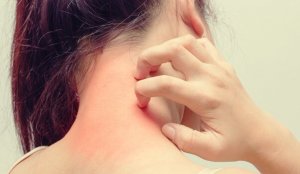Dermatite atopique et stress : quelle est leur relation ?