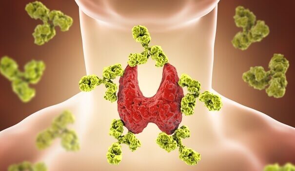 thyroïde