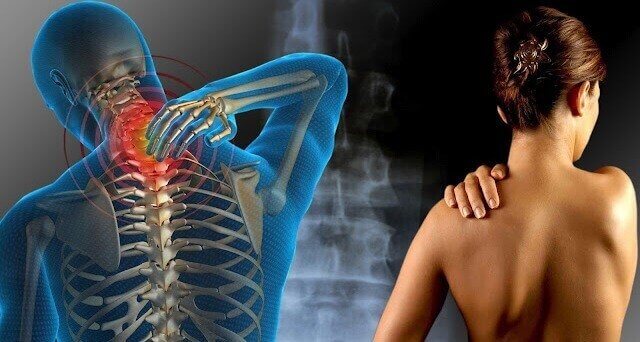 fibromyalgie 