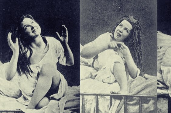 Charcot et les femmes hystériques