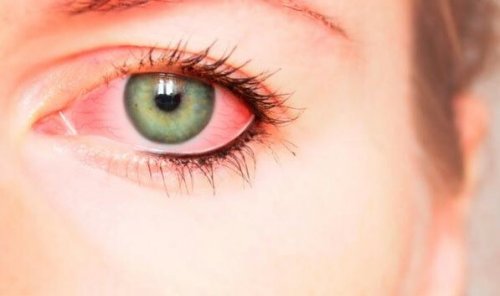 la violence psychologique peut provoquer des épanchements oculaires