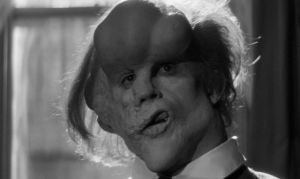 Elephant Man, une réflexion sur la dignité humaine