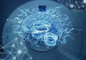 Différences entre le scanner et l'IRM