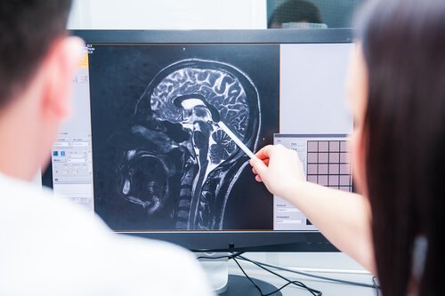 différences entre le scanner et l'IRM