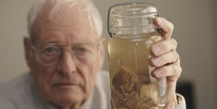 Harvey montrant le cerveau d'Albert Einstein