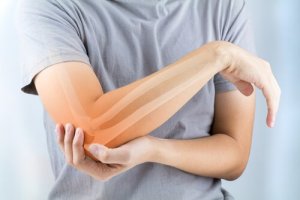 Arthrite rhumatoïde : symptômes, causes et traitement