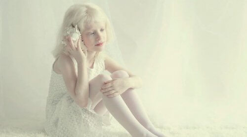 personnes albinos
