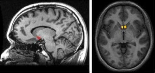 le noyau accumbens
