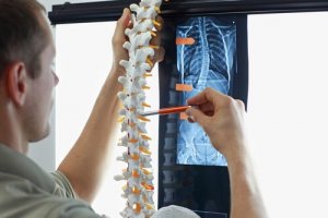 4 exercices pour prévenir la scoliose