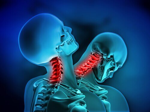 coup de fouet cervical