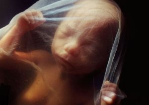 Le traumatisme de la naissance et ses effets