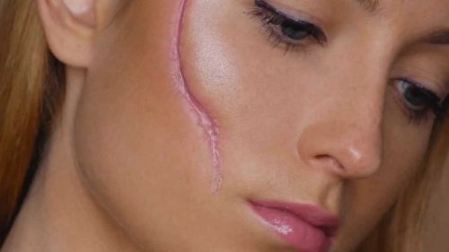 malformations faciales