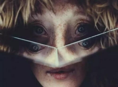 malformations faciales