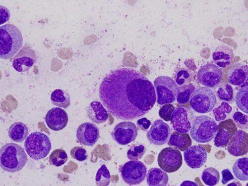 réponse immunitaire et types de lymphocytes
