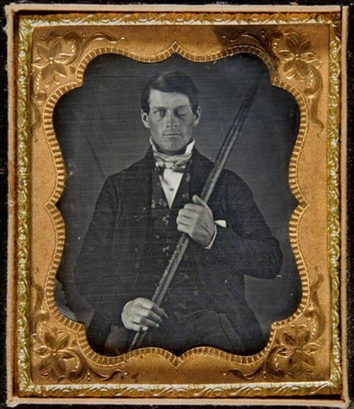 phineas gage et l'anomalie cérébrale