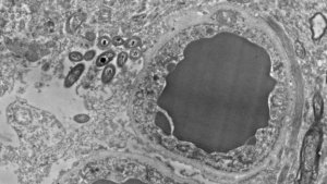 Microbiome cérébral: une bactérie intestinale se trouverait dans le cerveau humain