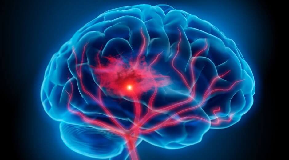 magie et cerveau
