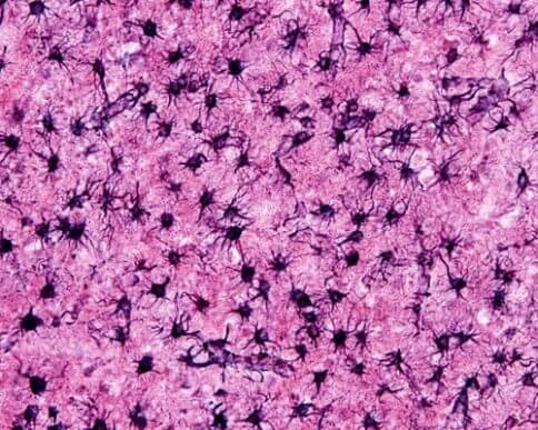 Les astrocytes, une pièce maîtresse de notre système nerveux