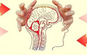 Les effets de la préoccupation sur le cerveau