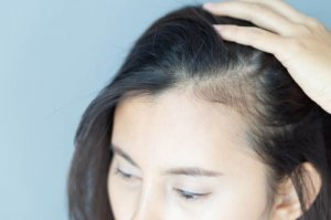 Conséquences psychologiques de l'alopécie chez les femmes