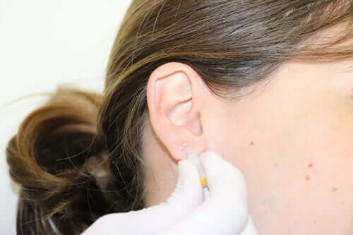 Soigner les maladies neurogénératives par l'acupuncture