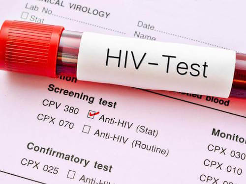 La journée mondiale du VIH : importance de faire le test