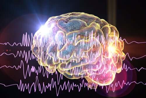 Le cerveau d'une personne en pleine crise d'épilepsie.