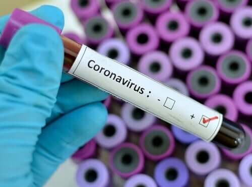 Un test pour détecter le coronavirus