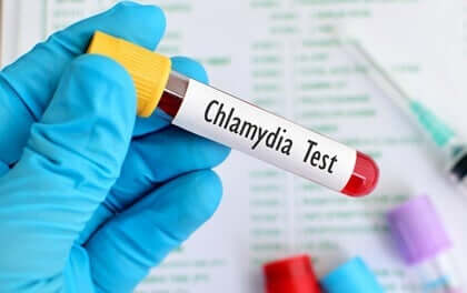 La chlamydia, une maladie sexuellement transmissible très courante