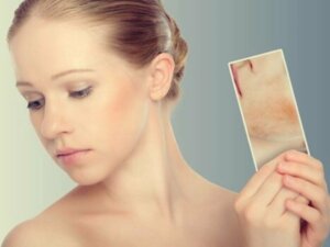 Taches de stress : quand la peau réagit aux émotions