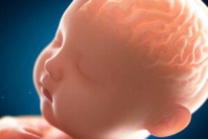 Pachygyrie : lorsque le cerveau est "lisse"