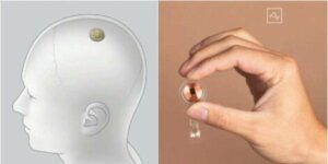 Neuralink : la puce qui connectera le cerveau à l'ordinateur