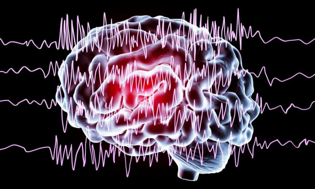 Une illustration d'un cerveau en crise. 