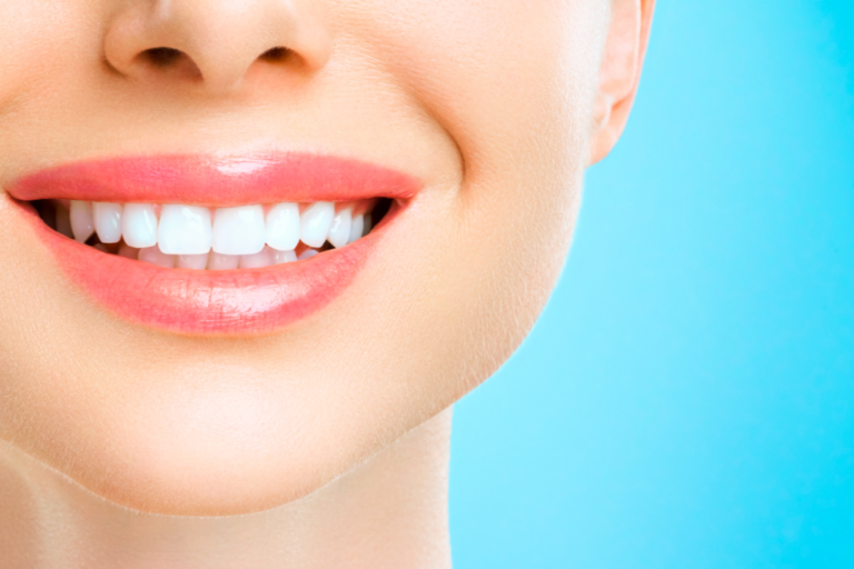 Blancorexie : la dangereuse obsession des dents blanches