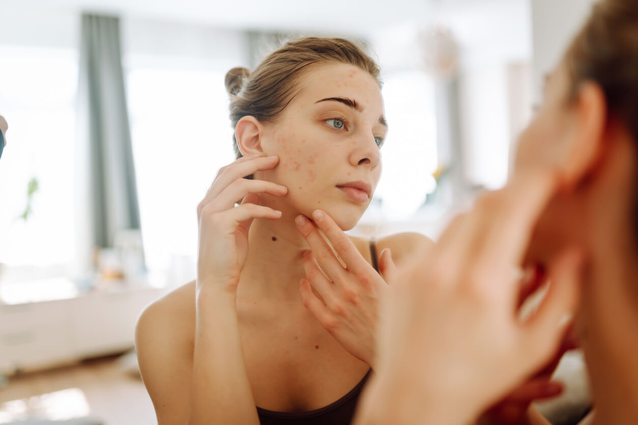 Comment la santé de la peau peut-elle affecter le bien-être émotionnel?